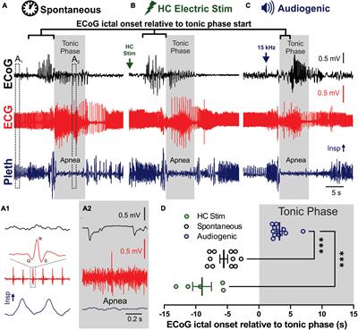 Forebrain epileptiform activity is not required for seizure-induced apnea in a mouse model of Scn8a epilepsy